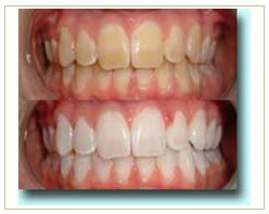 Slider image (7) Alfieri Dentista